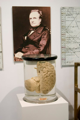 Charles Babbage donated half of his brain